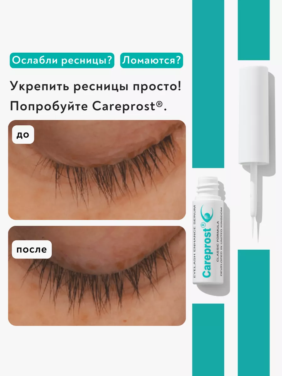 Careprost отзывы. Карепрост сыворотка для ресниц. Сыворотка для роста ресниц карепрост. Карепрост фото до и после. Сыворотка восстанавливающая ресницы.