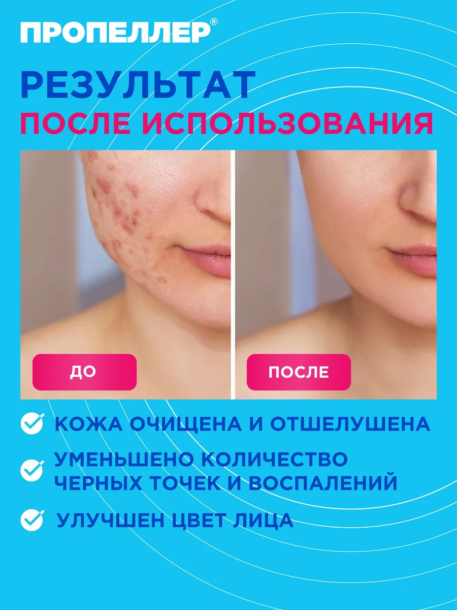 Пропеллер скатка отзывы. Пропеллер пилинг-скатка 100мл салиц 2в1.